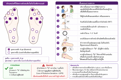 Monofilament ที่ตรวจความรู้สึกเท้า ผู้ป่วยเบาหวาน