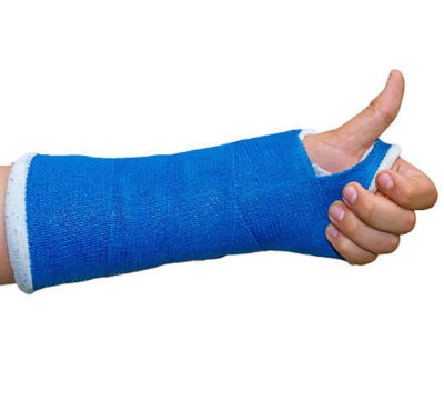 เฝือก Delta Lite Plus 3 นิ้วx4หลา [Fiberglass] - BSN (1 ม้วน)