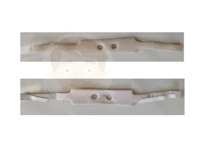 ที่ผูกท่อเจาะคอ Tracheostomy Tube Holder - Portex (อเมริกา)