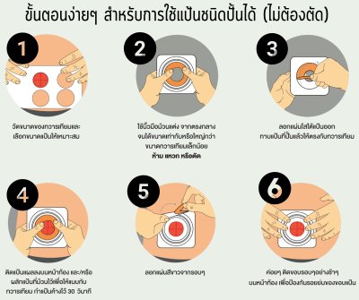 แป้น Convatec Moldable แบบปั้นได้ 45 มม. กลาง (medium stoma 22-33 มม.) (411802) (1 แผ่น)
