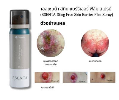 Esenta Skin Barrier Spray สเปรย์ซิลิโคนปกป้องผิว