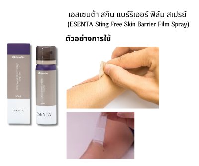 Esenta Adhesive Remover Spray 50ml ลอกกาวที่ติดผิวหนัง