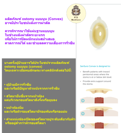 แป้นก้นถ้วย พร้อมถุงอุจจาระ Coloplast Sensura Ostomy Bag Convex Light Opaque (15509) (1 ชิ้น)