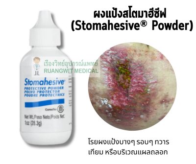 Stomahesive Powder ผงรักษาแผลรอบรูเปิดทวารเทียม