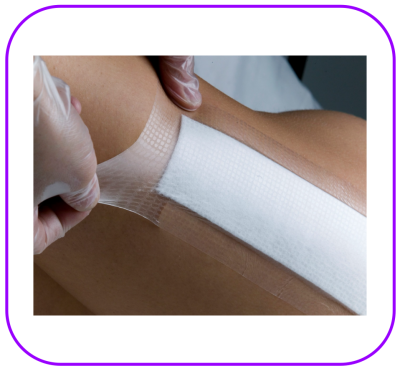 Opsite Post-OP 9.5x8.5 cm  แผ่นเทปใสปิดแผลกันน้ำพร้อมแผ่นซับ (1 แผ่น)