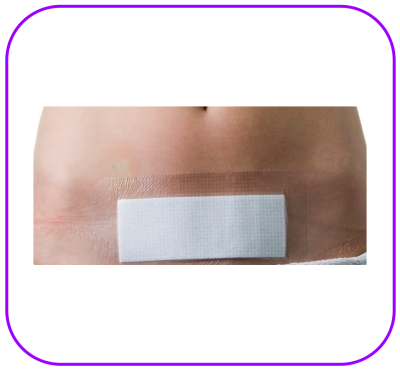 Opsite Post-OP 20x10 cm  แผ่นเทปใสปิดแผลกันน้ำพร้อมแผ่นซับ (1 แผ่น)