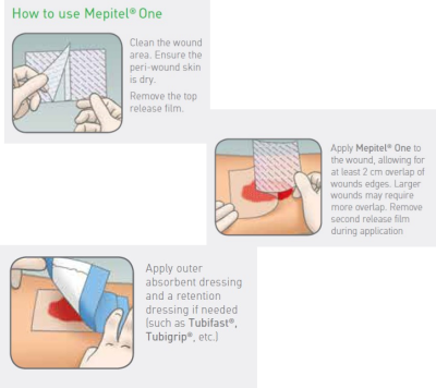 Mepitel One 10x18 cm แผ่นปิดแผลชนิดตาข่ายซิลิโคน (1 แผ่น)