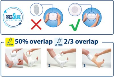 Urgo K2 Latex Free ระบบพันแผลแบบกดทับสองชั้น