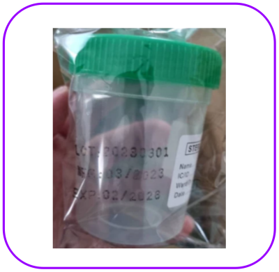 กระป๋องเก็บปัสสาวะสเตอไรด์ Urine Container Sterile (1 อัน)