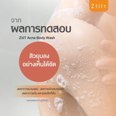 ZiiiT Acne Scalp Hair Shampoo150ml. + ZiiiT Acne Body Wash150ml.แชมพู+เจลอาบน้ำ ช่วยดูแลเรื่องสิว