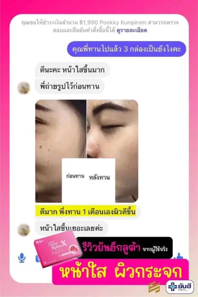 Yanhee Gluta Alpha X ยันฮี กลูต้า อัลฟ่า เอ็กซ์ Best Sale !!!