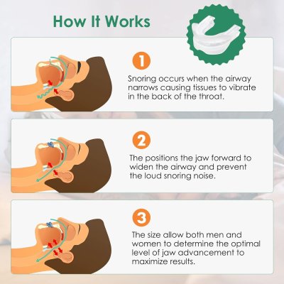 SnoreEase: Professional Reusable Anti-Snoring Device for Men