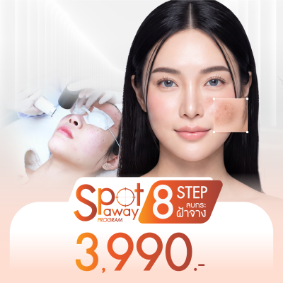 โปรโมชั่น โปรแกรม Spot Away