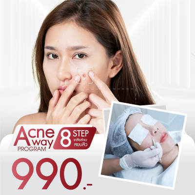 โปรโมชั่น โปรแกรม Acne Away