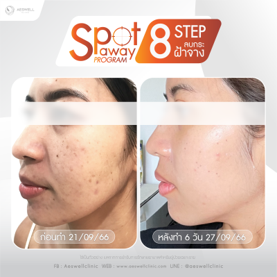 รีวิวจากผู้ใช้บริการจริง โปรแกรม Spot Away