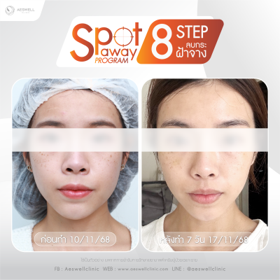 รีวิวจากผู้ใช้บริการจริง โปรแกรม Spot Away