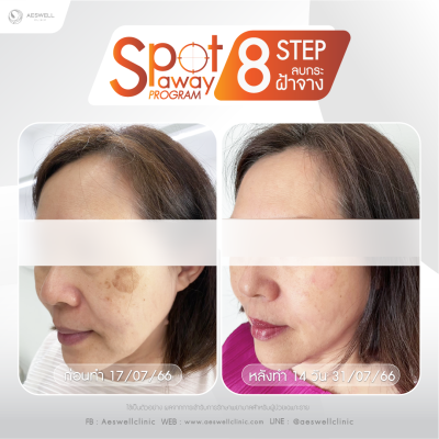 รีวิวจากผู้ใช้บริการจริง โปรแกรม Spot Away