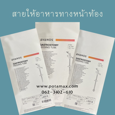 Gastrostomy tube feeding สายให้อาหารทางหน้าท้อง