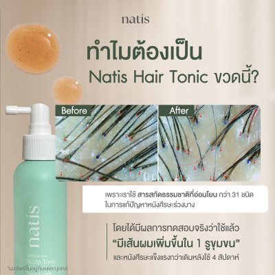 Natis Anti Hair Loss Scalp Tonic (100ml.) สเปรย์ลดผมร่วง กระตุ้นผมเกิดใหม่ บำรุงหนังศีรษะ