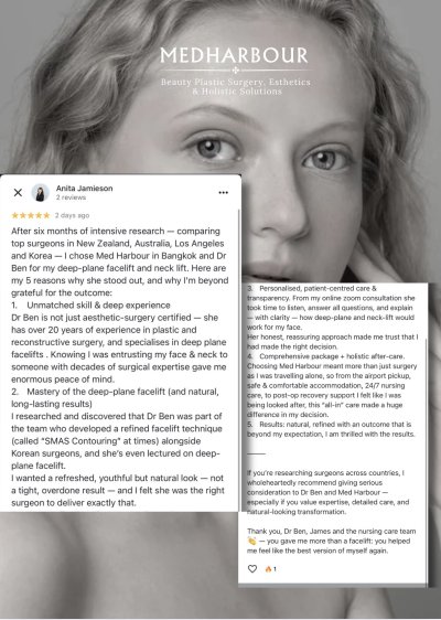 Deep Plane Facelift with Free Necklift