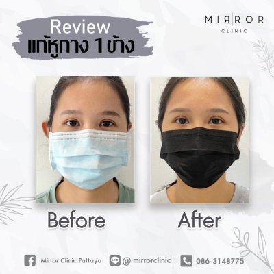 รีวิวหูกาง