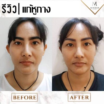 รีวิวหูกาง