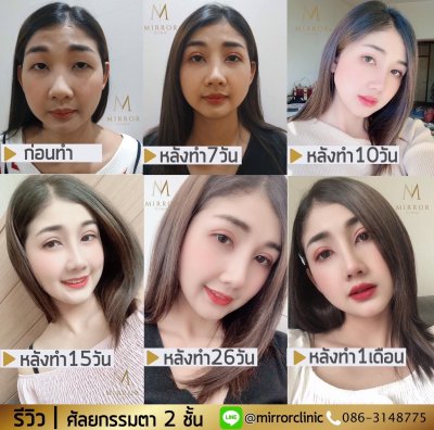 รีวิวตา