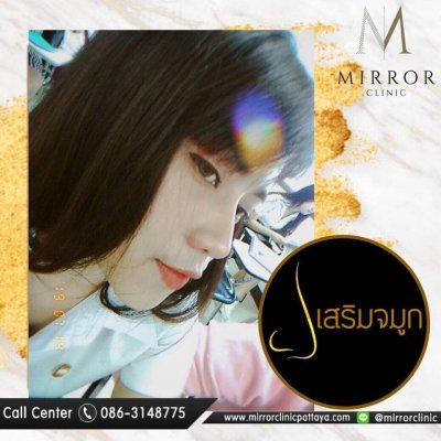 รีวิวเสริมจมูก