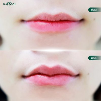 รีวิววววววว