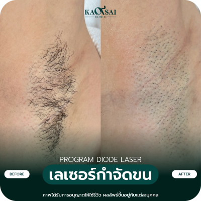 รีวิว Diode