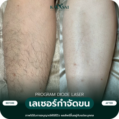 รีวิว Diode