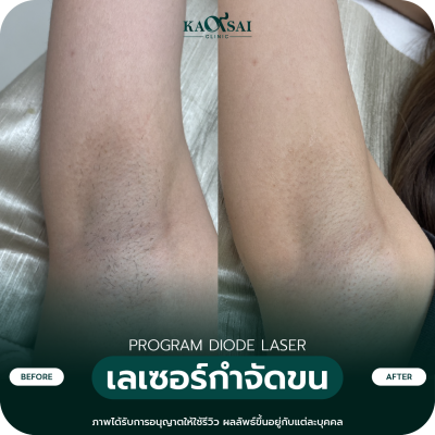 รีวิว Diode