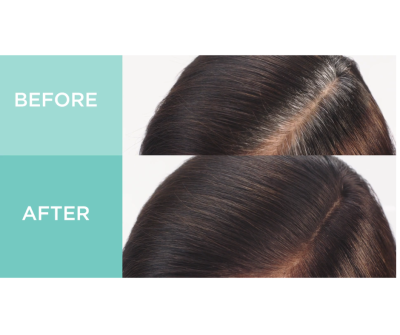 L'Oréal, Magic Root Rescue, 10 Minute Root Coloring Kit from USA
