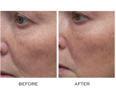 Elemis Peptide4 Thousand Flower Mask 75ml from UK