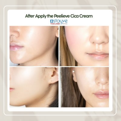 MEDISCO Peelieve Cica Cream (2 ml)