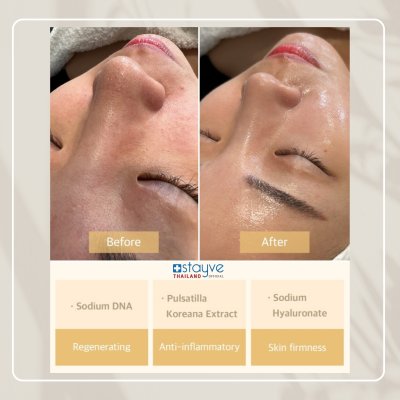 Stayve Salmon DNA Gold Ampoule