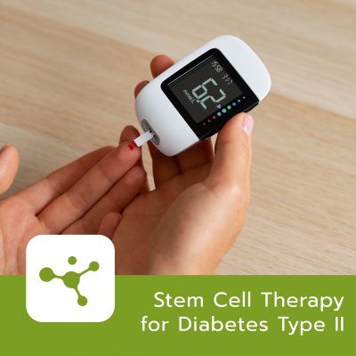 Stem Cell for Type II Diabetes