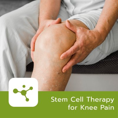 Stem Cell for Osteoarthritis (Knee Pain)