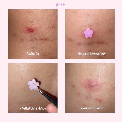 Grrrbeauty Popstar! Grrr Hydrocolloid Acne Patches (2 แผ่น 24 ชิ้น) เกอบิวตี้ แผ่นแปะ ลาย popstar!