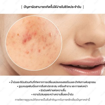 Dr.Ceuracle Vegan BHA & Matcha Ampoule (30ml) ดร.ซูราเคิล แอมพูลชาเขียว + BHA กระชับรูขุมขน ลดสิว คุมมัน