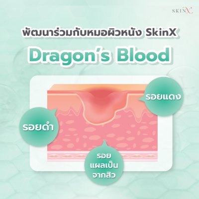 SkinX X-Roy Scar Gel (10g) สกินเอ็กซ์ เจลลดรอย