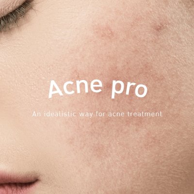 The Skin Collection Acne Pro Serum (30ml) เซรั่มลดสิว แอคเน่ โปร