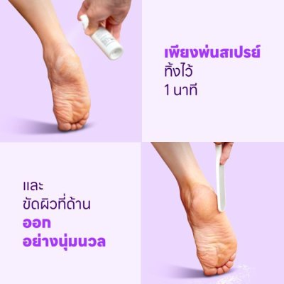 Baren Foot Softener (100ml) บาเรน สเปรย์ ฉีดบริเวณส้นเท้าแตก เพื่อให้เซลล์ผิวตายอ่อนตัวลง พร้อมที่จะขัดออก