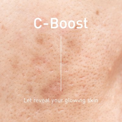 The Skin Collection C-BOOST Serum (30ml) เซรั่มวิตามินซี ช่วยให้ผิวกระจ่างใส