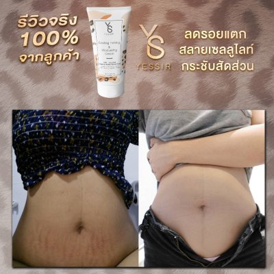 [EXP: 05/2026] Yessir เยสเซอร์ ครีมกระชับสัดส่วน ลดรอยแตก และเซลลูไลท์ 150ml Cooling Firming & Moisturizing cream
