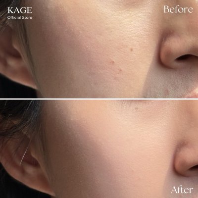 Kage Retouch Cushion Balm คาเกะ คุชชั่นบาล์ม รีทัชบาล์ม