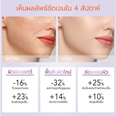 Y.O.U Reeffect Boost Retinol Moisturizer (50g) ยู เรตินอลมอยซ์เจอไรเซอร์
