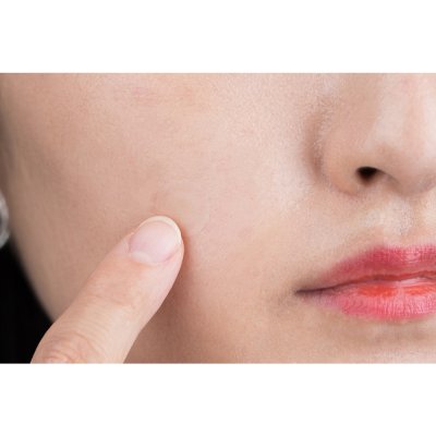 Elaband Elaband HydroDot (1 กล่องมี 23 แผ่น) เอล่าแบนด์ แผ่นแปะสิวเกาหลี แผ่นเจลไฮโดรด็อท