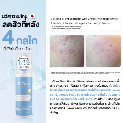 D.Dee Anti-Acne Body Spray (30ml) ดีดี สเปรย์ฉีดสิวหลังและลำตัว