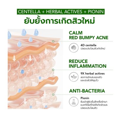 Y.O.U Acneplus Spot Care X (15g) ยู บาล์มแต้มสิว